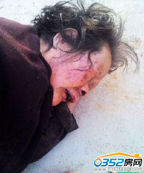 八旬老太慘遭毆打