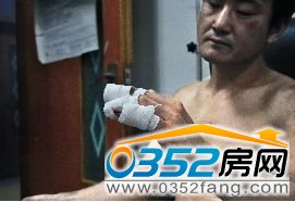 傷者徐某,他左手3根手指被膠布纏住